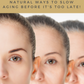 Anti Aging - Natural Ways to Slow Aging by Emily Patridge - Eco Wellness Lab